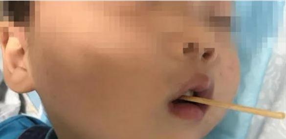分享决窍“CT看穿仪怎样看穿竹签“推荐4个购买渠道